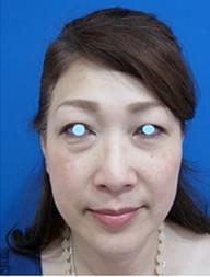 Before写真