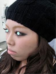 Before写真