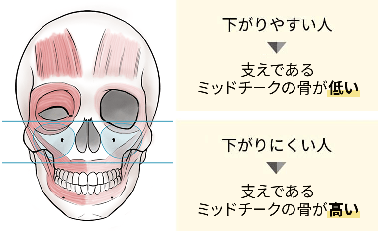 下がりやすい人、ミッドチークが低い・下がりにくい人、ミッドチークは高い