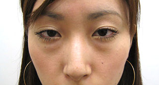 Before写真
